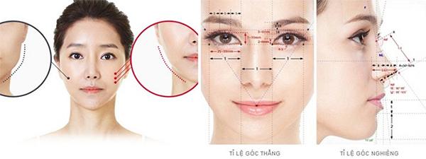 Độn cằm V Line là gì? Độn cằm có đau và nguy hiểm không? - 3