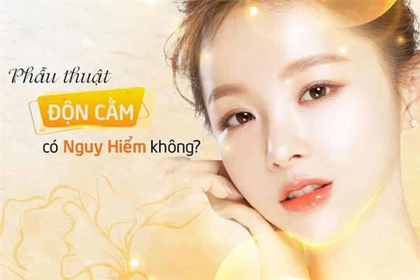 Độn cằm V Line là gì? Độn cằm có đau và nguy hiểm không? - 6