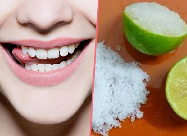 8 Cách làm trắng răng bị vàng ố tại nhà an toàn, hiệu quả - 2