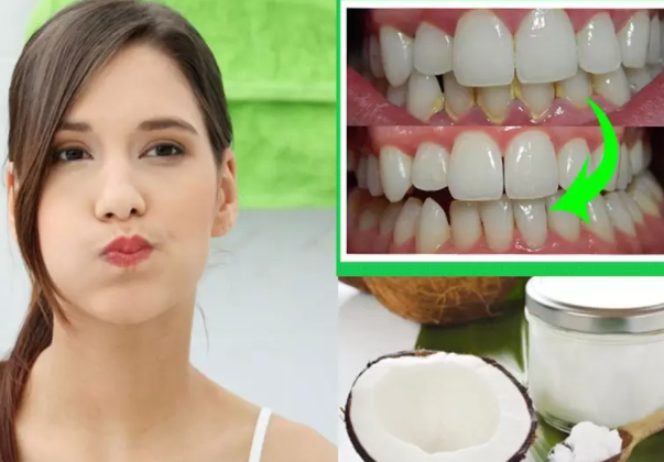 8 Cách làm trắng răng bị vàng ố tại nhà an toàn, hiệu quả - 9