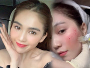 Làm đẹp - Ngọc Trinh xuất hiện với gương mặt chảy máu, chuyện gì thế này!