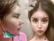 Người phụ nữ trẻ gây hoang mang vì phẫu thuật thẩm mỹ quá đà