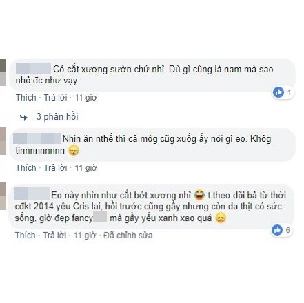 Phát hoảng vì thủ thuật cắt xương sườn để có vòng eo con kiến - 25