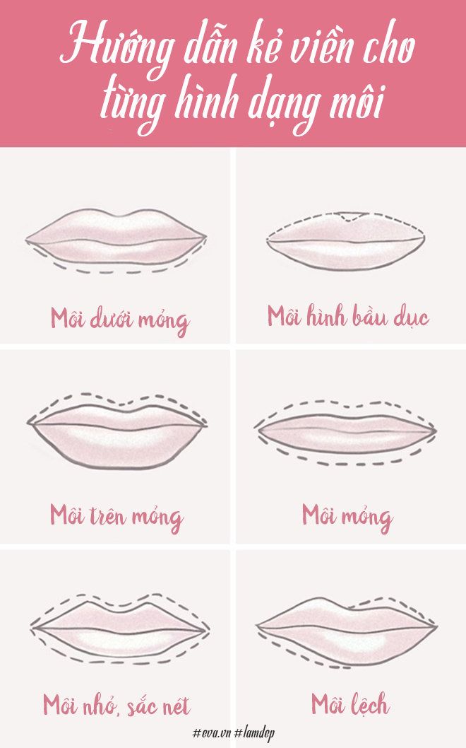 Tùy từng dáng môi của mỗi người mà chúng ta sẽ có cách phẫu thuật môi khác nhau.
