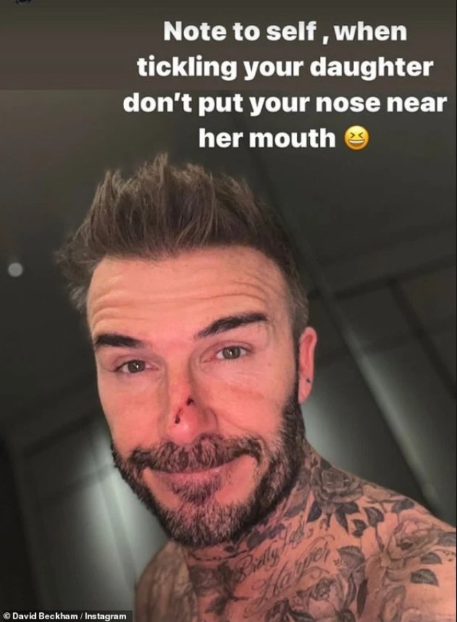 Beckham mới tiết lộ sự cố với Harper cách đây không lâu.