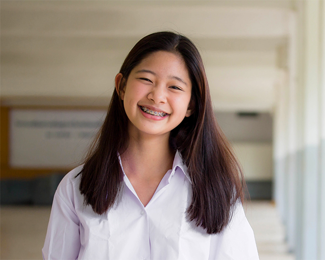 Mắc cài kim loại được nhiều phụ huynh lựa chọn vì hiệu quả và giá thành