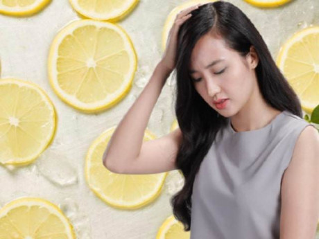 Chăm sóc tóc, làm sạch da đầu hiệu quả ngay tại nhà với mẹo trị gàu bằng chanh siêu dễ