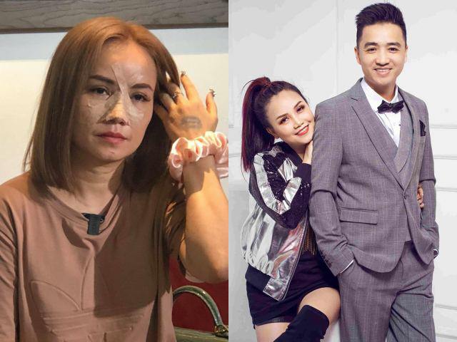 Diễn viên Đào Hoàng Yến từng bị người chồng thứ 4 đánh gãy mũi ở quán ăn dù đã ly hôn. Đến nay, cả 2 vẫn nhiều lần lời qua tiếng lại trên mạng xã hội.