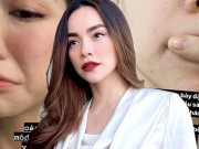 Làm đẹp - Hà Hồ tự làm "chuột bạch" thử nghiệm mỹ phẩm, da bong tróc, hỏng luôn mặt tiền