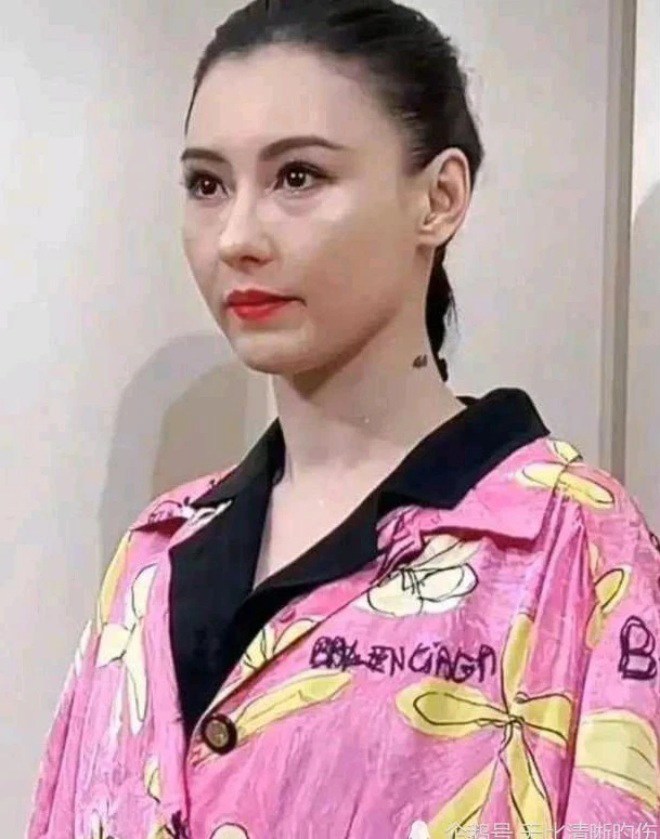 Gương mặt của Trương Bá Chi thực sự khiến người đối diện giật mình.