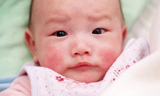 Mách mẹ bí kíp chăm sóc da bé mùa đông mà mẹ đừng nên bỏ lỡ - 1