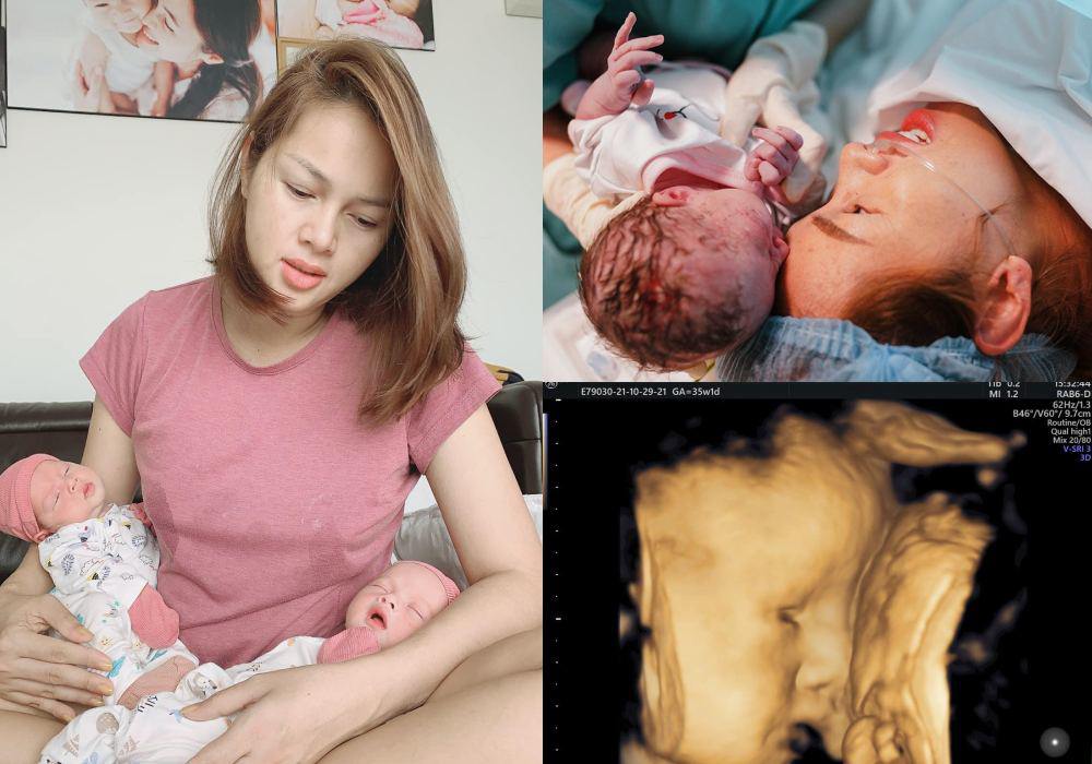 Clara và Jolie sở hữu những đường nét xinh xắn từ khi còn trong bụng mẹ, sống mũi cao ấn tượng. 