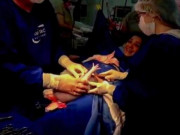 Bà bầu - Chào đời thấy còn bị "nhốt", bé sơ sinh đấm vỡ túi ối làm bác sĩ té ngửa