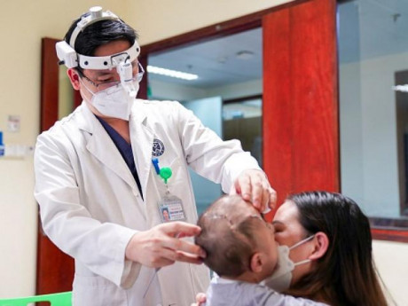 Mẹ chết lặng khi con chào đời với đầu hình tháp, mắt không thể nhắm khi ngủ và cái kết