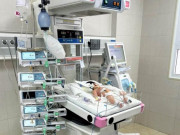 Sức khỏe - Mẹ suýt “ôm hận” sau 2 ngày chữa viêm da cho con sơ sinh theo cách nhiều người làm