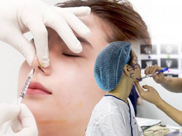 Cuối năm, chị em đổ xô tiêm chất làm đầy tăng đột biến, chuyên gia nhắn nhủ một điều