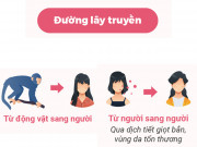 Sức khỏe - Biết ngay 8 điều này để không bị lây bệnh đậu mùa khỉ khi Việt Nam đã có ca mắc