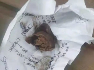 Sau sinh người cứ thoang thoảng mùi hôi, sản phụ rùng mình thấy vật đen sì rơi ra từ cơ thể