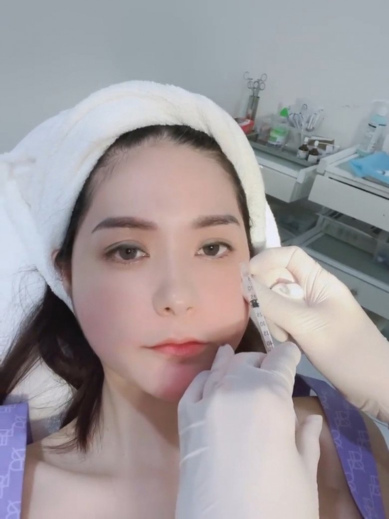 Kim xâu vào da mặt, nữ đại gia Quận 7 vẫn bình thản livestream, khoe trẻ ra chục tuổi - 8