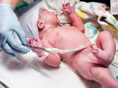 Chuyến đi đẻ hú hồn của sản phụ 37 tuần nhập viện khi dây rốn thai nhi đã sa ra ngoài âm hộ