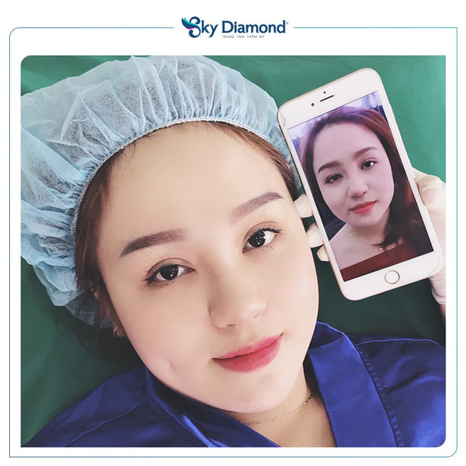 Phụ nữ trung niên nên treo mày hay cắt mí? - 2