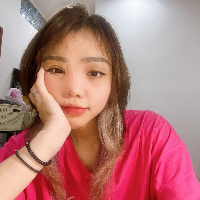 Bất ngờ cuộc sống mới của cô gái Đà Nẵng bị chồng sắp cưới tạt axit, hình ảnh hiện tại gây ngỡ ngàng - 3