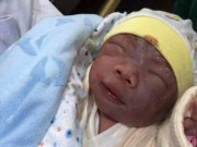Làm mẹ - Bé sơ sinh chào đời bị gia đình chối bỏ vì quá xấu, 1 tháng sau lột xác nhận không ra