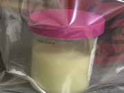Sức khỏe - Người phụ nữ có nước tiểu trắng như sữa, đi khám giật mình khi biết có “sinh vật lạ” ở trong