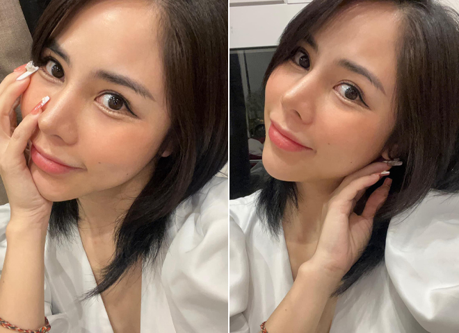 Được biết, ngoài nâng mũi thì bạn gái Huỳnh Anh chỉ can thiệp dao kéo thêm duy nhất 1 điểm trên gương mặt nữa – đó là mí mắt. Mỹ nhân VTV cho biết, sau sinh, mắt cô có phần sụp xuống nên cô đã nhấn mí để trông trẻ hơn.