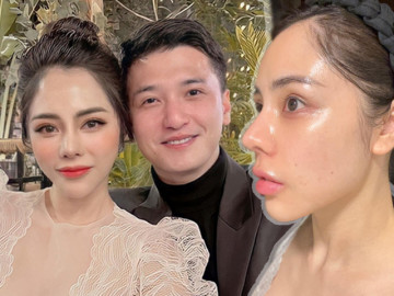 Sửa mũi 8 tiếng vẫn bị mang danh "nữ hoàng mặt nhựa”, bạn gái Huỳnh Anh dự định chỉnh lần 2