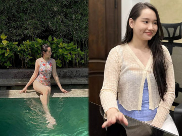 Hậu tăng cân chóng mặt, Trúc Anh nay diện đẹp bikini, khó che những vết đỏ tím chằng chịt