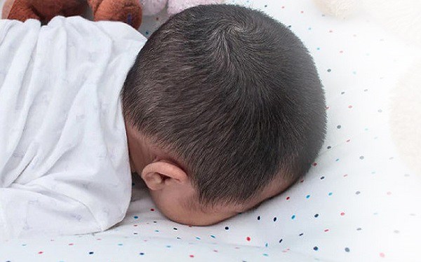 Việc trẻ nhỏ dưới 1 tuổi nằm úp mặt xuống chăn, đệm rất dễ xảy ra hội chứng ngừng thở khi ngủ. (Ảnh minh họa)