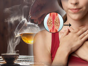 Sức khỏe - Uống loại trà này tăng nguy cơ mắc ung thư thực quản đến 90%, nếu làm thêm một điều càng nguy hơn