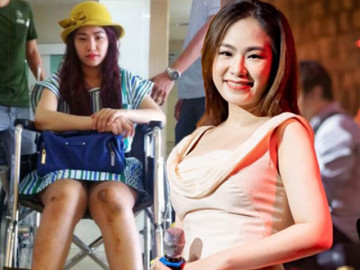 Từng bị bỏng cấp độ 2, Lương Bích Hữu trở lại ấn tượng không cần son phần