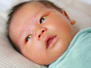 Bà bầu - Da vàng đậm toàn thân, bé 3 ngày tuổi thay máu toàn phần: Sau sinh cẩn trọng phát hiện điều này ở trẻ