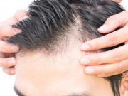 Sức khỏe - "Tự sướng" nhiều có thể gây hói đầu? Chuyên gia tình dục tiết lộ điều này mới đáng lo