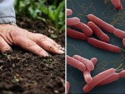 Sức khỏe - Phát hiện 3 người mắc bệnh Whitmore, có 2 trẻ nguy kịch