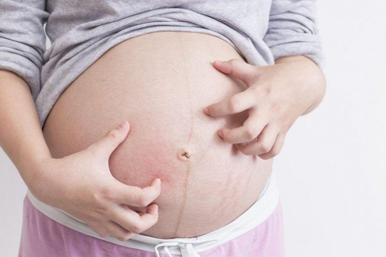 Những phụ nữ chưa bao giờ phá thai sẽ có nhiều khả năng mang thai cao hơn, ít gặp biến chứng khi bầu bí và đi đẻ an toàn. (Ảnh minh họa)