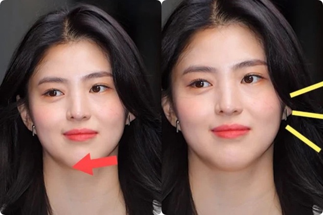 Nếu để ý kỹ sẽ thấy gương mặt của Han So Hee hơi lệch với phần cằm vuông và hai bên gò má không cân xứng. Cằm vuông và dày khiến gương mặt nhìn lúc nào cũng to đầy đặn và rất dễ xuất hiện nọng cằm.