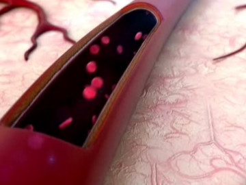 Bệnh nhồi máu cơ tim thường xảy ra ở những đối tượng nào?