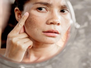 Sức khỏe - 3 việc không nên quá chăm kẻo chưa 30 tuổi đã già như 60, bệnh tật đầy mình