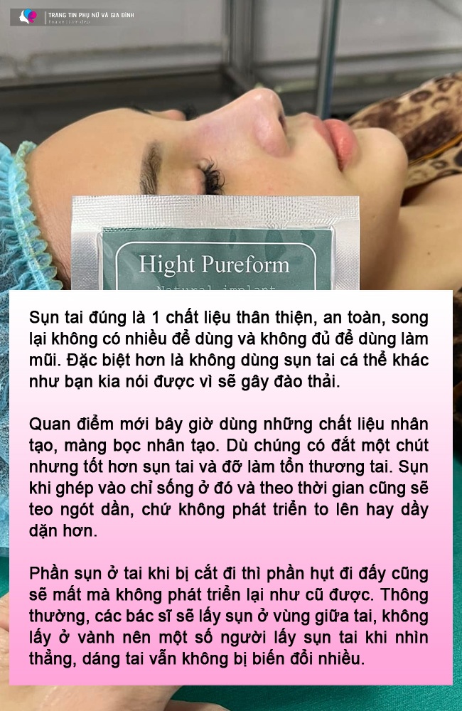 Đòi lấy sụn tai bạn trai nâng mũi, gái xinh làm cõi mạng lao đao, bác sĩ trả lời thế nào? - 6