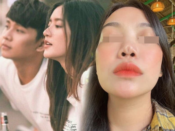 Đòi lấy sụn tai bạn trai nâng mũi, gái xinh làm cõi mạng lao đao, bác sĩ trả lời thế nào?