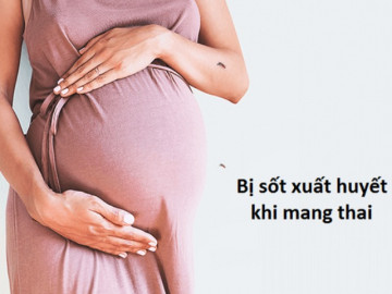 Sốt xuất huyết nguy hiểm với phụ nữ mang thai, xử trí thế nào để ngừa biến chứng?