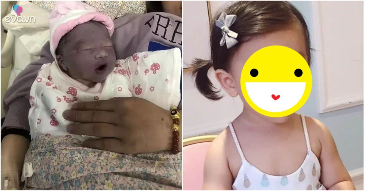 View - Bé sơ sinh chào đời đen như than, 3 tháng sau lột xác ngỡ ngàng