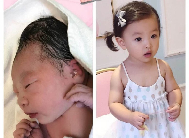 View - Bé sơ sinh chào đời đen như than, 3 tháng sau lột xác ngỡ ngàng