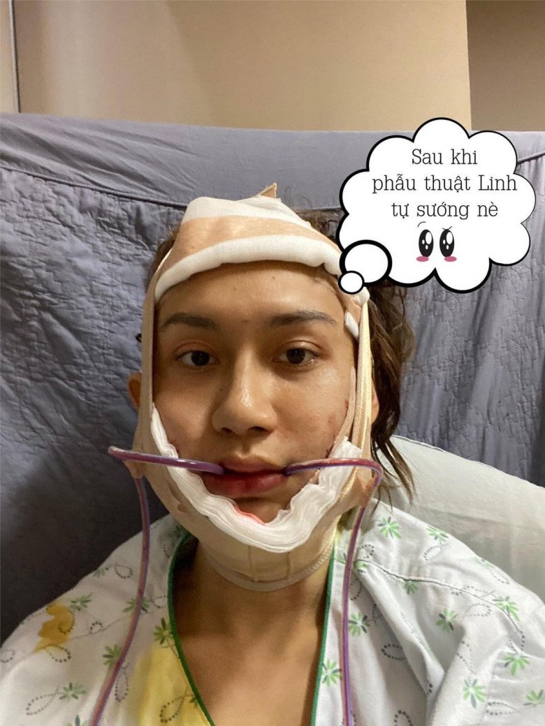 Người đẹp cũng trai qua nhiều lần dao kéo tại Hàn Quốc để gương mặt được nữ tính hơn.