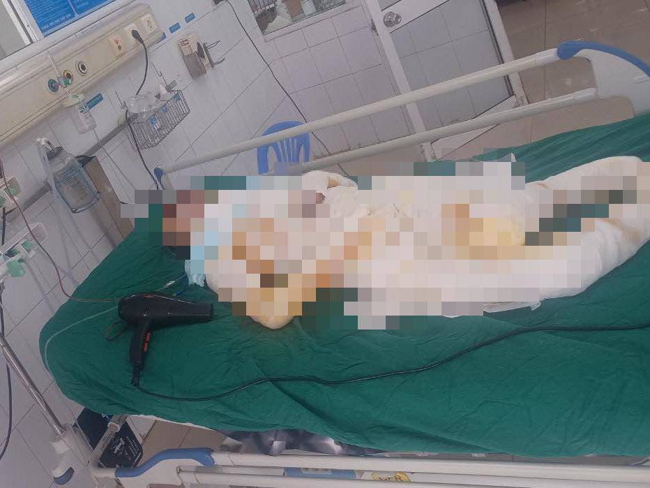 Bà Đ. - nạn nhân trong vụ 3 con gái mang xăng đốt nhà mẹ đang tiên lượng nặng.