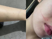 Tin tức - Đang bầu 7 tháng, thai phụ bị chồng bạo hành đến mức không đi lại được mới dám gọi về cho bố mẹ đẻ