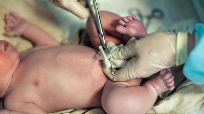 Dịch vụ lấy và lưu trữ tế bào gốc dây rốn được thực hiện ở nhiều bệnh viện với các mức chi phí khác nhau. (Ảnh minh họa)